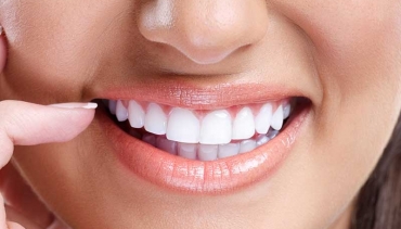 Cosmetic Dentistry