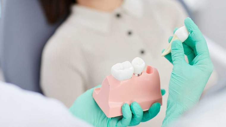 The 7 Ways To Avoid A Swelling If You Are Getting A Tooth Extraction In Melbourne
