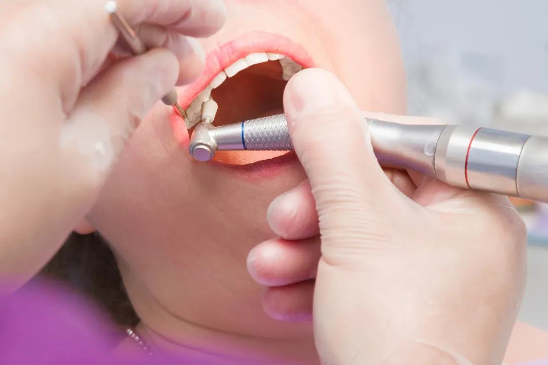 Teeth Cleaning Melbourne